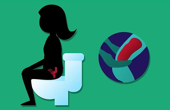 帮助你健康的使用马桶,这个东西英文叫poop footstool。小编带大家看看这个神器: 一个踩在脚下的小板凳 正常的使用马桶姿势,图中显示此时直肠的状态,呈弯曲装 上图,卡住啦,有了小板蹬,直肠状态如下图 有了小板凳,直肠也直起来腰来,哈哈 公元1700之前,人们都是蹲式的,直肠是直的 有了马桶之后,直肠弯起腰来,各种卡呀 卡! 卡住了代谢产物,卡住了时间 小板凳的外观,多节高度可调,适合多种体型的人 重点是这个脚下的绿色的按摩器 可以按摩脚底的穴位,中医疗法,放松心情。 这个小
